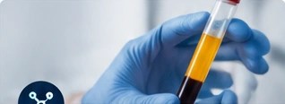 Muestra de plasma en un tubo de laboratorio